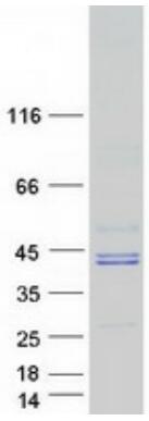 Coomassie blue staining of purified HLA-B protein.